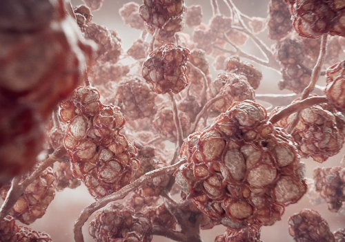 Vantive ECCO2R Mechanism of Action, Healthcare Awards Winner