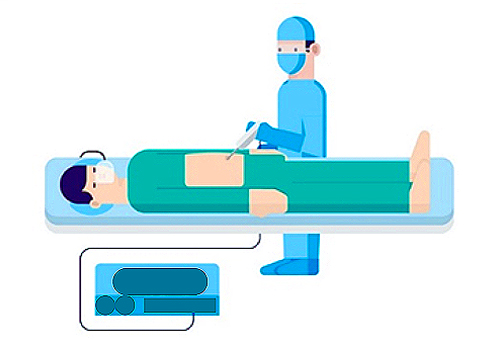 TITAN Health Awards Winner -  Medical Device with Ablation Technology  By Somashekharayya Hiremath