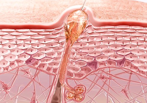 Etat Pur -  Acne Actives, Healthcare Awards Winner