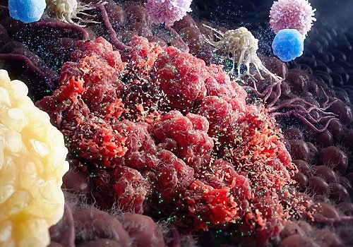 Targeting CTCL with Precision - The Power of IL2 Receptor Therapy, Healthcare Awards Winner