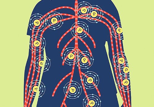 TITAN Health Awards Winner -  Managing hyperphosphatemia By American Kidney Fund