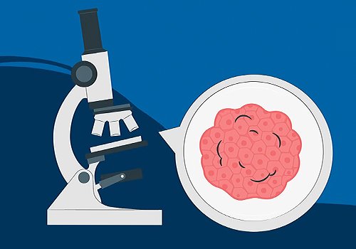 TITAN Health Awards Winner -  Know Your Kidneys: The Importance of Testing By American Kidney Fund