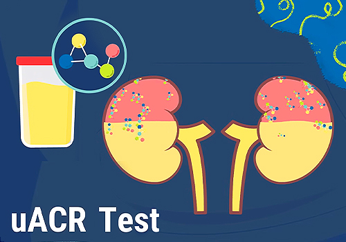  What is uACR Testing?, Healthcare Awards Winner